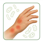 Antibacteriano