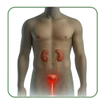 Infección urinaria
